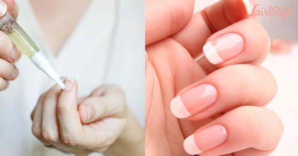3 Ingredient DIY Essential Oil That Is The Full-Proof Remedy For Your Dry & Brittle Nails!!