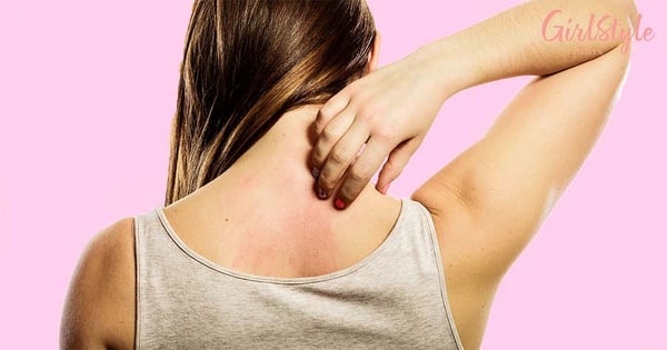 3 Essential Oils For Eczema To Calm & Hydrate Your Skin