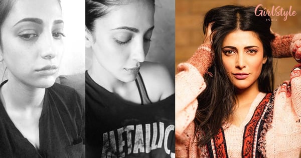 My Life, My Face: Shruti Haasan Gives It Back To People Trolling Her For Undergoing Plastic Surgery